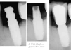 I2 Wide Platform (4.5) - 6