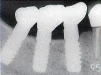 AQB - 5