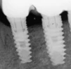 ICE (3.5) - 5