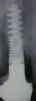 Dental Implant S (3.75) - 8