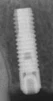 OsseoSpeed S (3.5,4.0) - 2