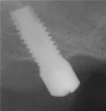 External Hexagonal Cylindrical (4.1) - 4
