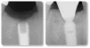 HA Coated (2.0) - 3