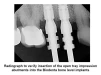 Bone Level-BL B2 (3.1) - 3