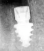Grip (3.5) - 9