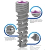 MAI Maintained Active Implant (3.5) - 3