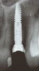 XiVE S (3.0) - 7