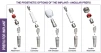 Unique Titanium Implant (UTI) 2.43 - 12