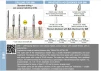 Solo Modular Titanium Implant (SMI) - 5