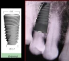 Unique Titanium Implant (UTI) 2.43 - 7