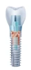 Alphatech - 1