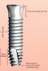 Helix TM - 2