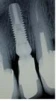 Master-L - 6