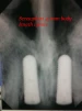 ScrewPlant (4.7) - 4