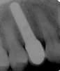 ScrewPlant (4.7) - 5