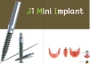 J1 Mini Implant - 3