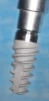 Paltop Active Implant PAI sp - 4