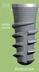 Tapered Implus Internal Hex Wide Thread Polished Neck (4.0) - 4