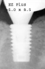 EZ Plus Internal Wide (5.0) - 8