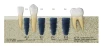 BLUEDIAMOND RC (AnyRidge Octa 1 RC) - 8