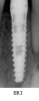 ERI (4.0) - 3