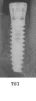 TSI (3.25) - 5