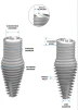 Deep Conical INVERTA Co-Axis 4.0mm-5.0mm - 4