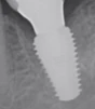 Max 7 (5.0) - 2