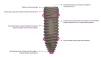 ESI-Essential Spectrum Implant-Conical Hex Connection RP (4.3/5.0/6.0) - 3