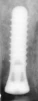 Standard (RN) - 2