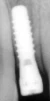 Standard Plus (NN) - 2