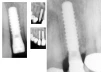 Standard Plus (NN) - 7