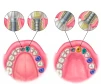 Anatomic (AW) - 2