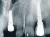 Anatomic (AN) - 4