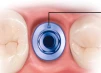 Anatomic (P) - 4