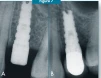 Anatomic (AW) - 6