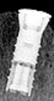 Autofix Classical - 4
