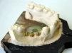Nanoimplant - 6