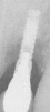 Micro-Vent SD (3.25) (Paragon) - 7
