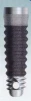 Micro-Vent Tapered SD (3.7) (Paragon) - 4
