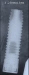 Full OSSEOTITE Parallel Walled (3.4)
