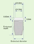 EW Type (6.0)