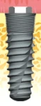 Atlas External Tapered (4.1)