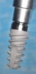 Paltop Active Implant PAI wp