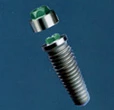 Nobel Replace External Hex (6.0) (Steri-Oss)