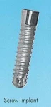 Star Vent Star Lock Screw