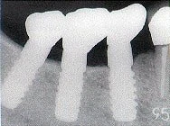 AQB