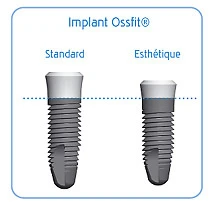 Ossfit (4.8)