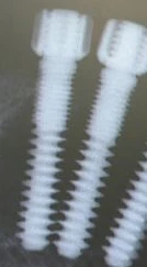 Dental Implant N