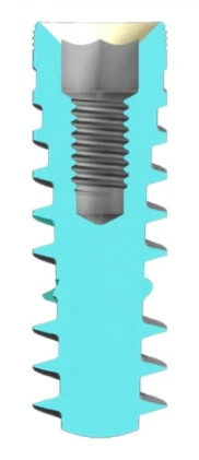 Cyclone (3.5)